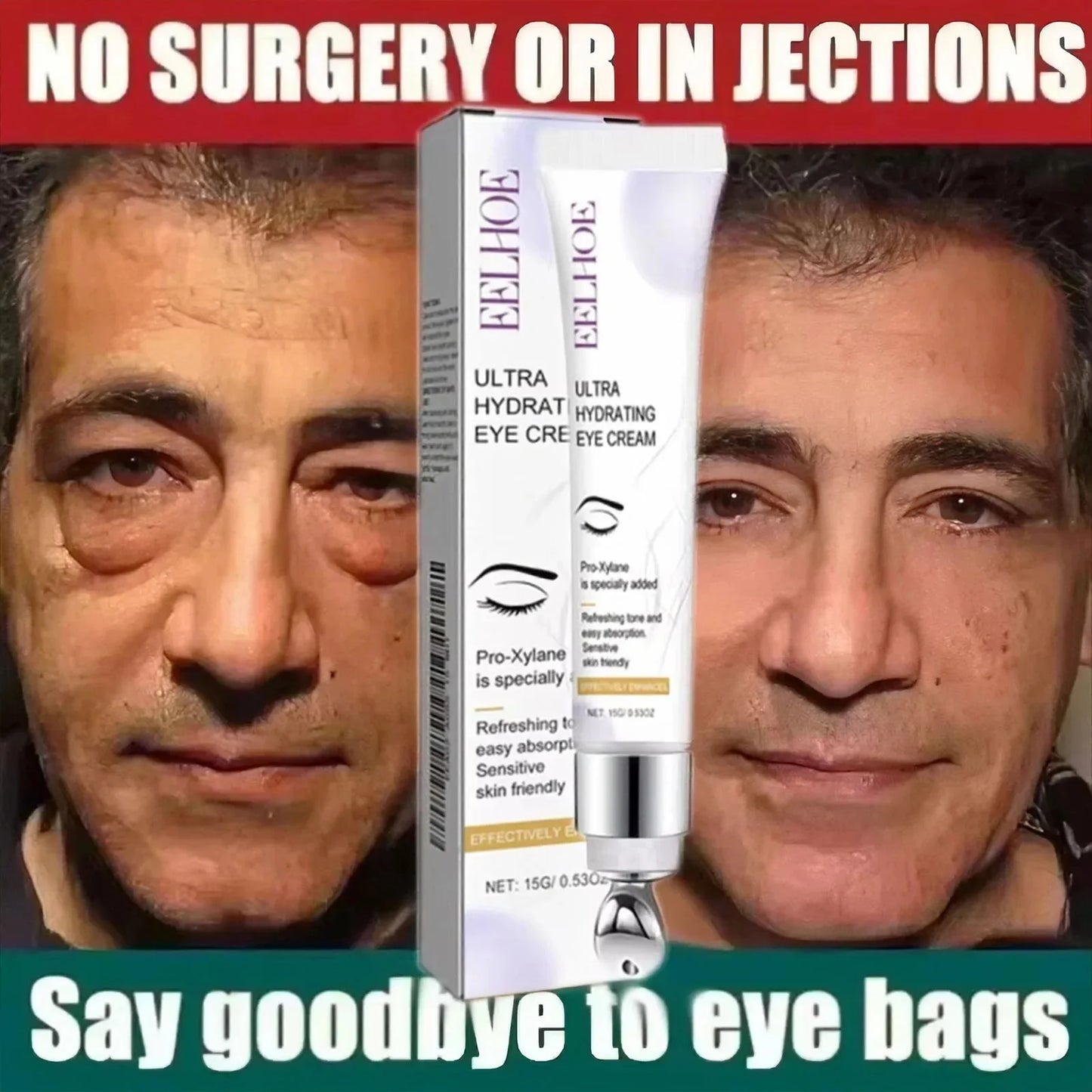 Retinol Eye Cream